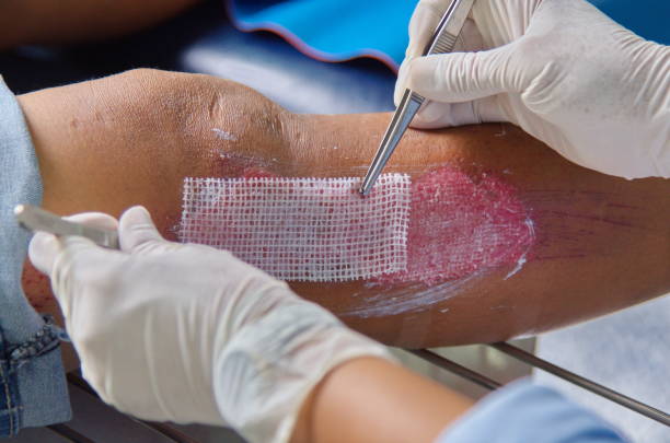 Wound Dressing & Catheter Care
